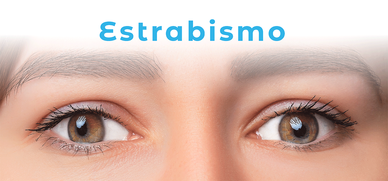 Estrabismo